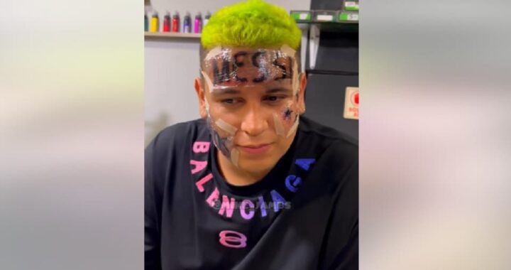Un supporter se fait tatouer Messi sur le front et regrette [VIDÉO]