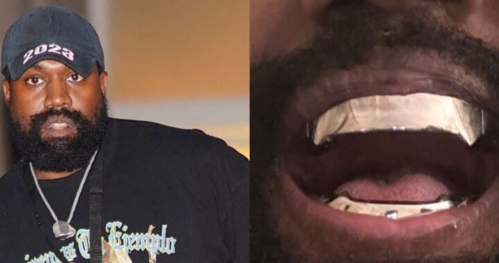 Kanye West porte des dents en titane à 850 000 $ !